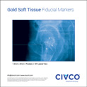 Gold Soft Tissue Markers, Prostate, MV, Lateral View