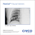 FlexiCoil, Lung, kV, AP View