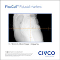 FlexiCoil, Prostate, kV, Lateral View