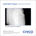 Gold Soft Tissue Prostate KV AP Lateral