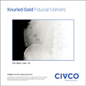 Gold Soft Tissue Markers, Liver, kV